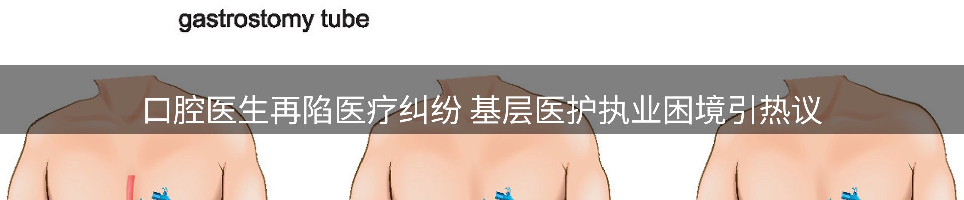 体育资讯